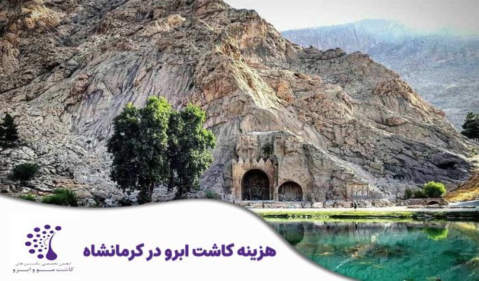 هزینه کاشت ابرو در کرمانشاه