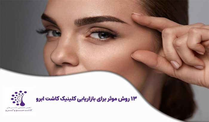 13 روش موثر برای بازاریابی کلینیک کاشت ابرو