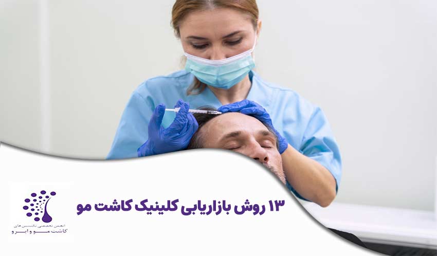 13 روش بازاریابی کلینیک کاشت مو